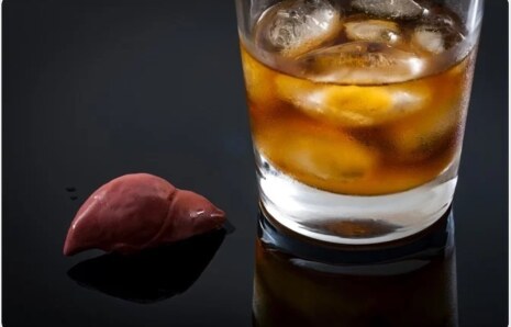 Alkolik Hepatit (AH) Nedir?